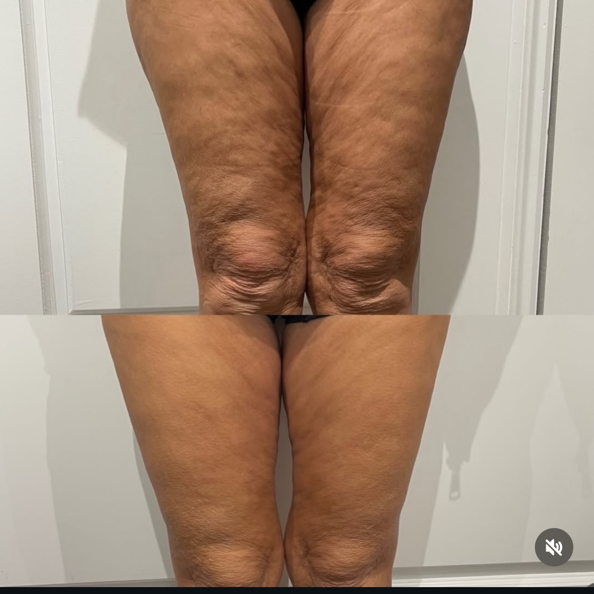 Laser Plus Spa Facebook ad: Just look at this transformation Our client wanted…