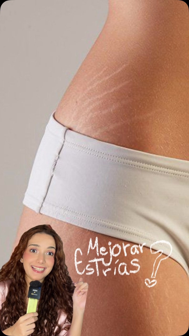 Arencia Global Facebook ad: TODOS podemos tener estrías y es algo super…