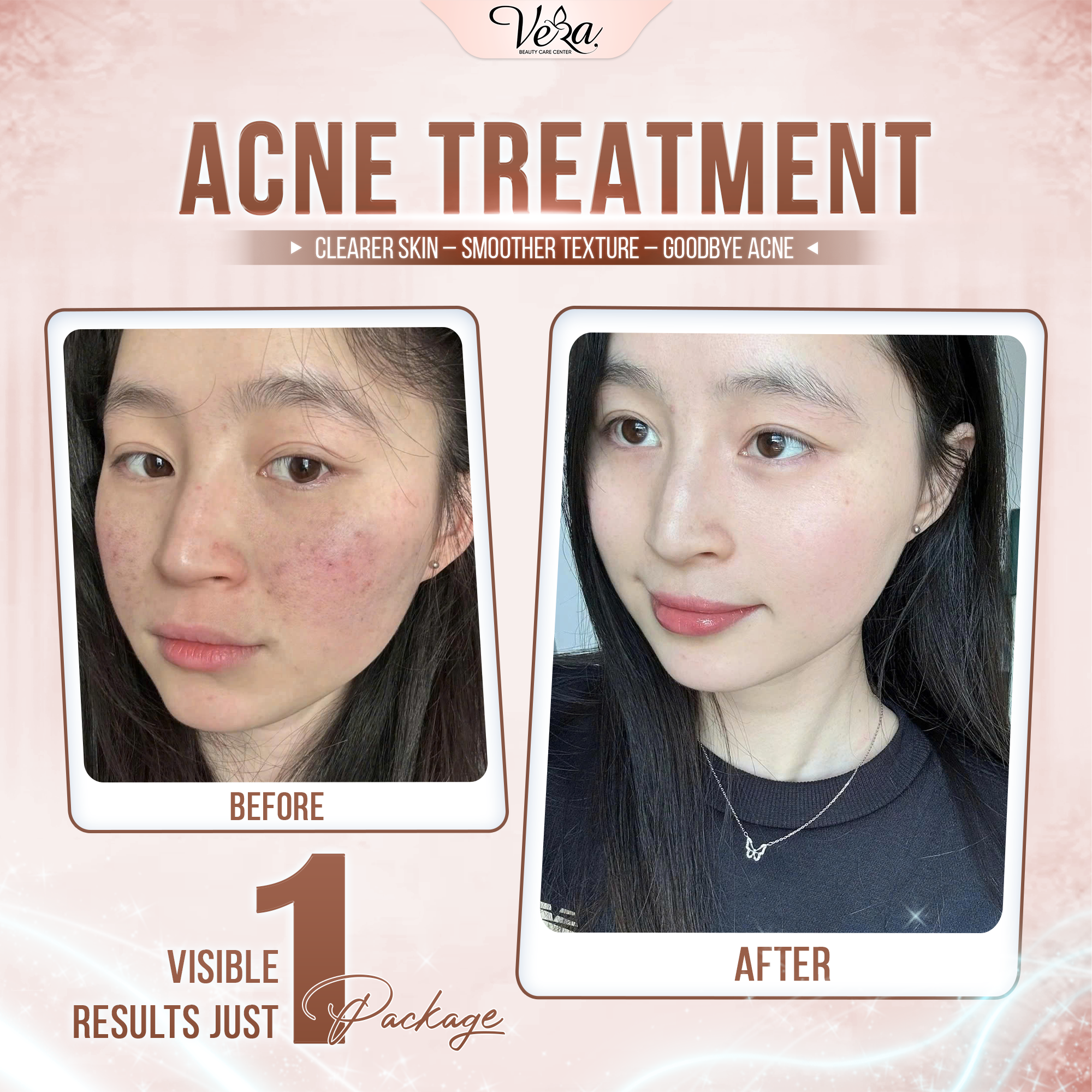 Vera Beauty Care Center Facebook ad