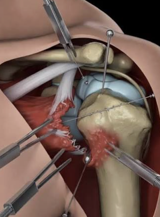 Dr. Elizabeth Monroe, MD Facebook ad: End That Chronic Pain in 3 Weeks