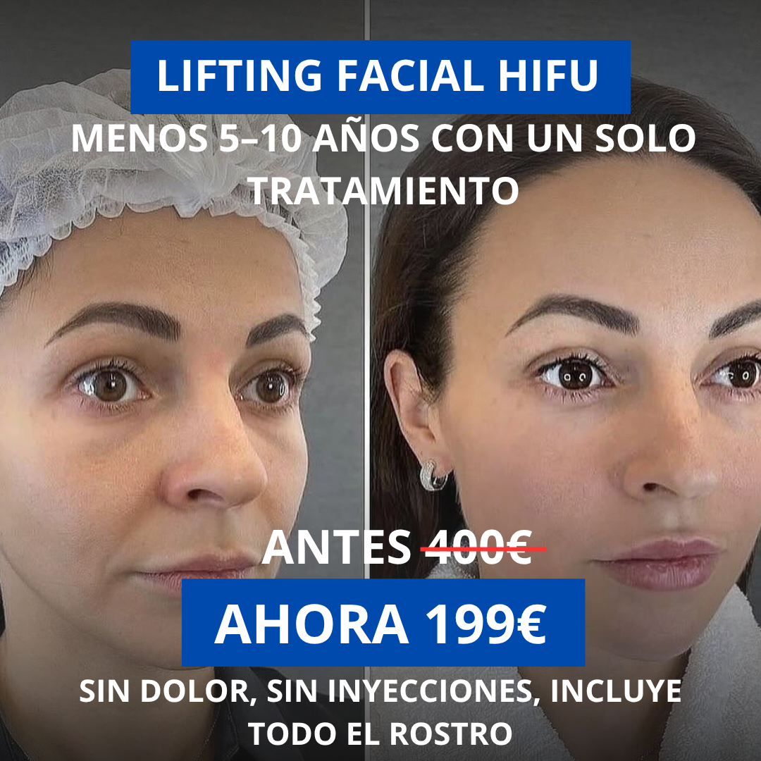 Smas lifting Barcelona Facebook ad: ¿Quieres lucir más joven sin cirugías ni inyecciones…