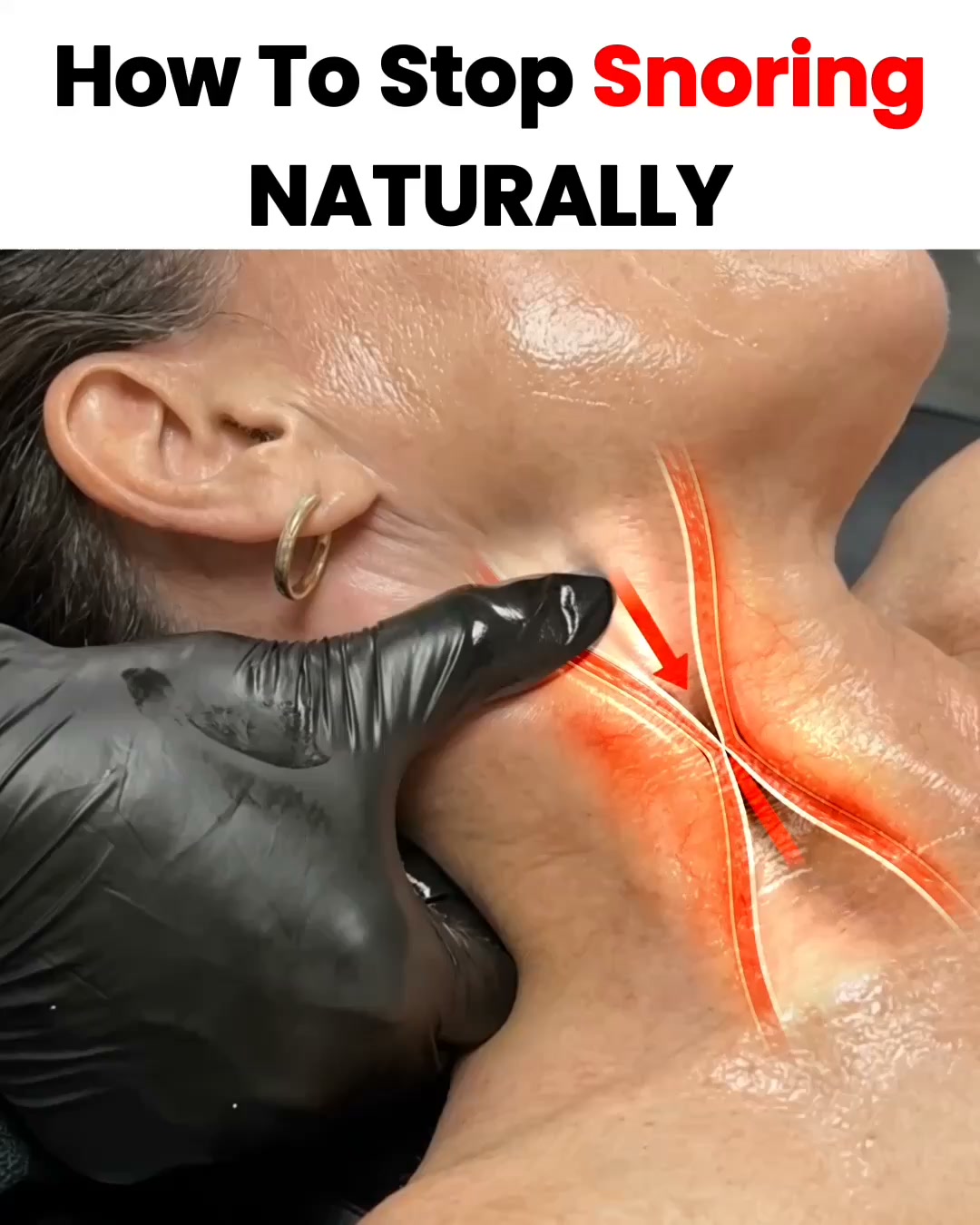 Honex Facebook ad: Fix Snoring & Sleepless Nights