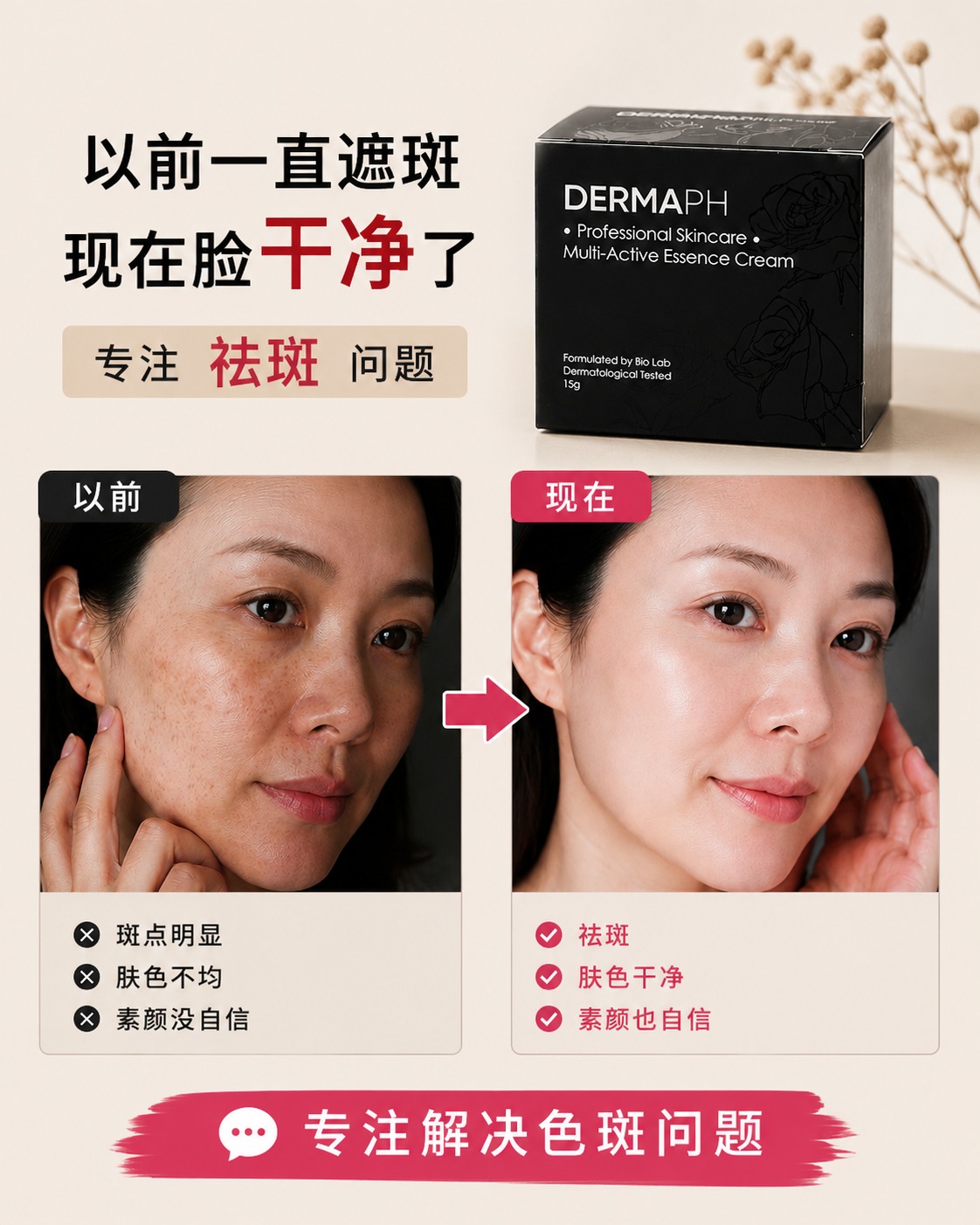 诗诗祛斑店铺 Facebook ad