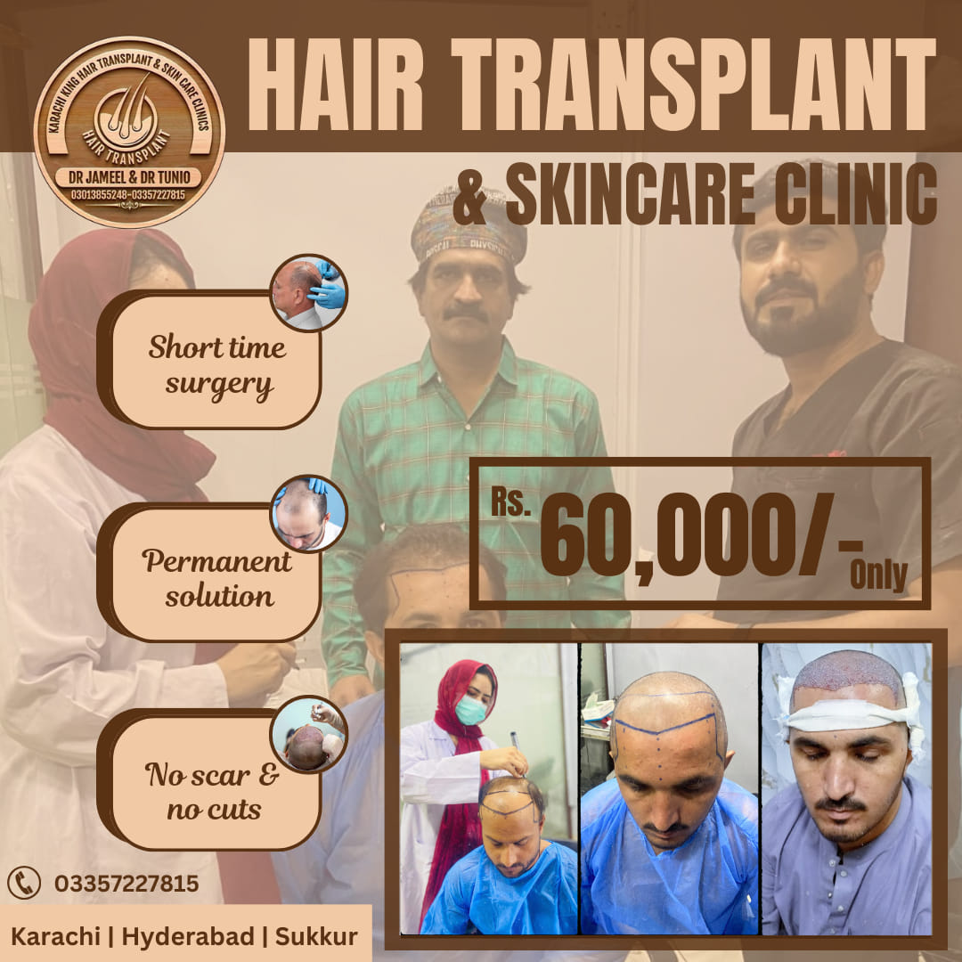 Karachi king skin care & hair transplant Facebook ad