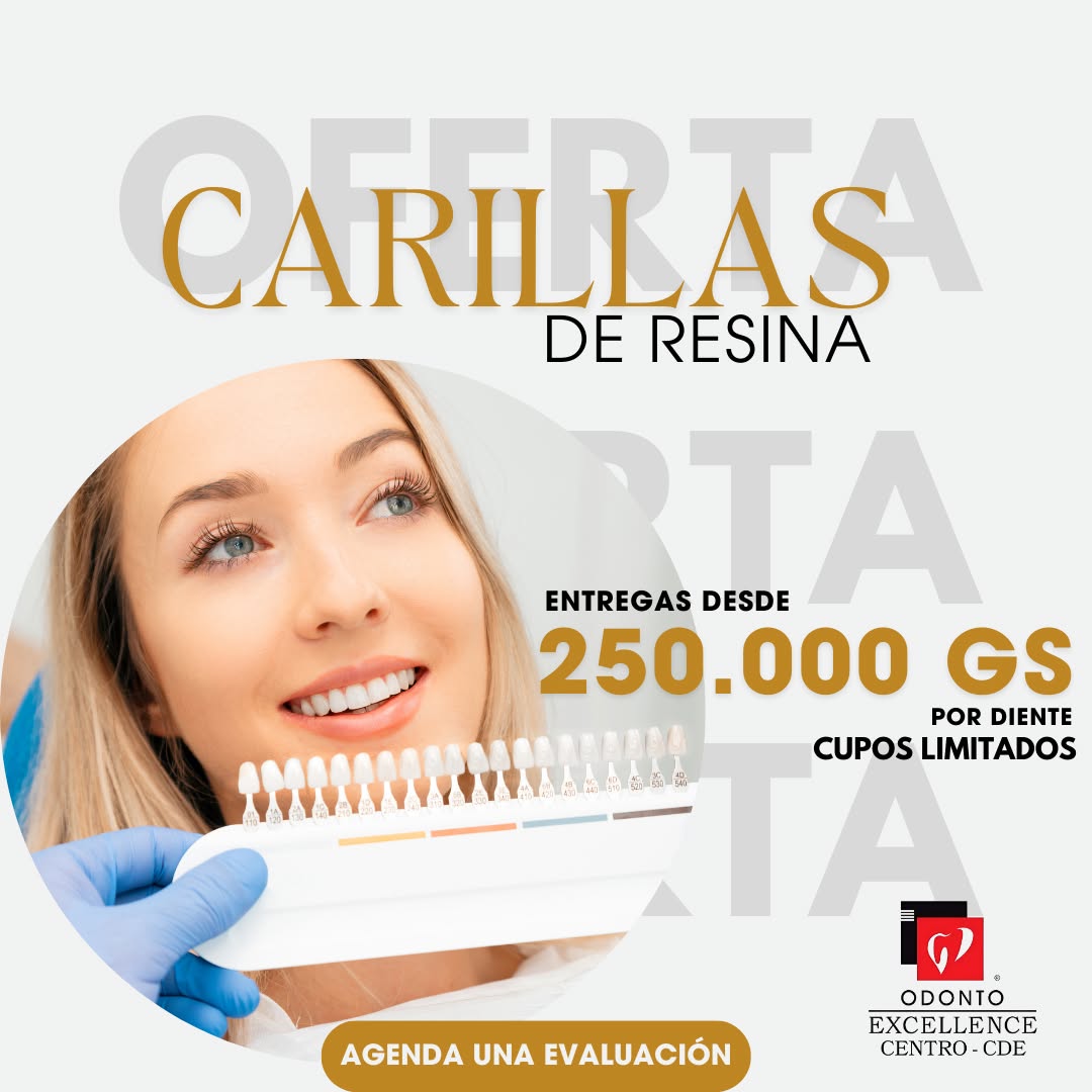 Odonto Excellence Ciudad del Este-Centro Facebook ad: Sonríe SIN FILTROS!