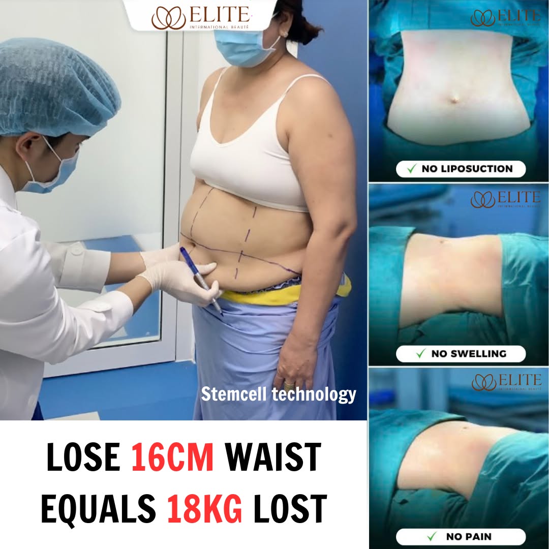 ELITE - No.1 Slimming Beauty Institute - Laguna Branch Facebook ad: Disscount Up To 30% First 20 customers only