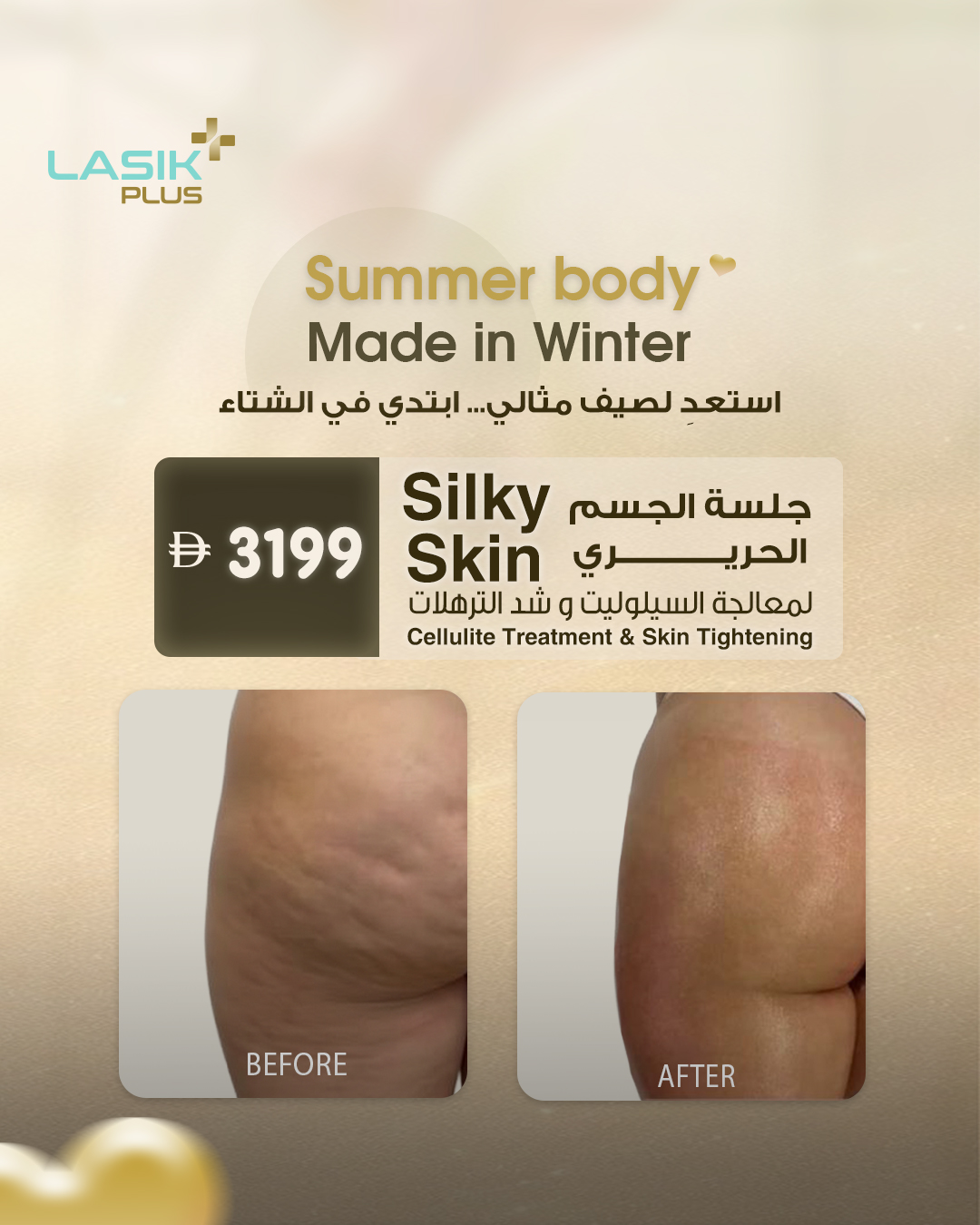 Lasik Plus Aesthetic Facebook ad from May 15, 2026