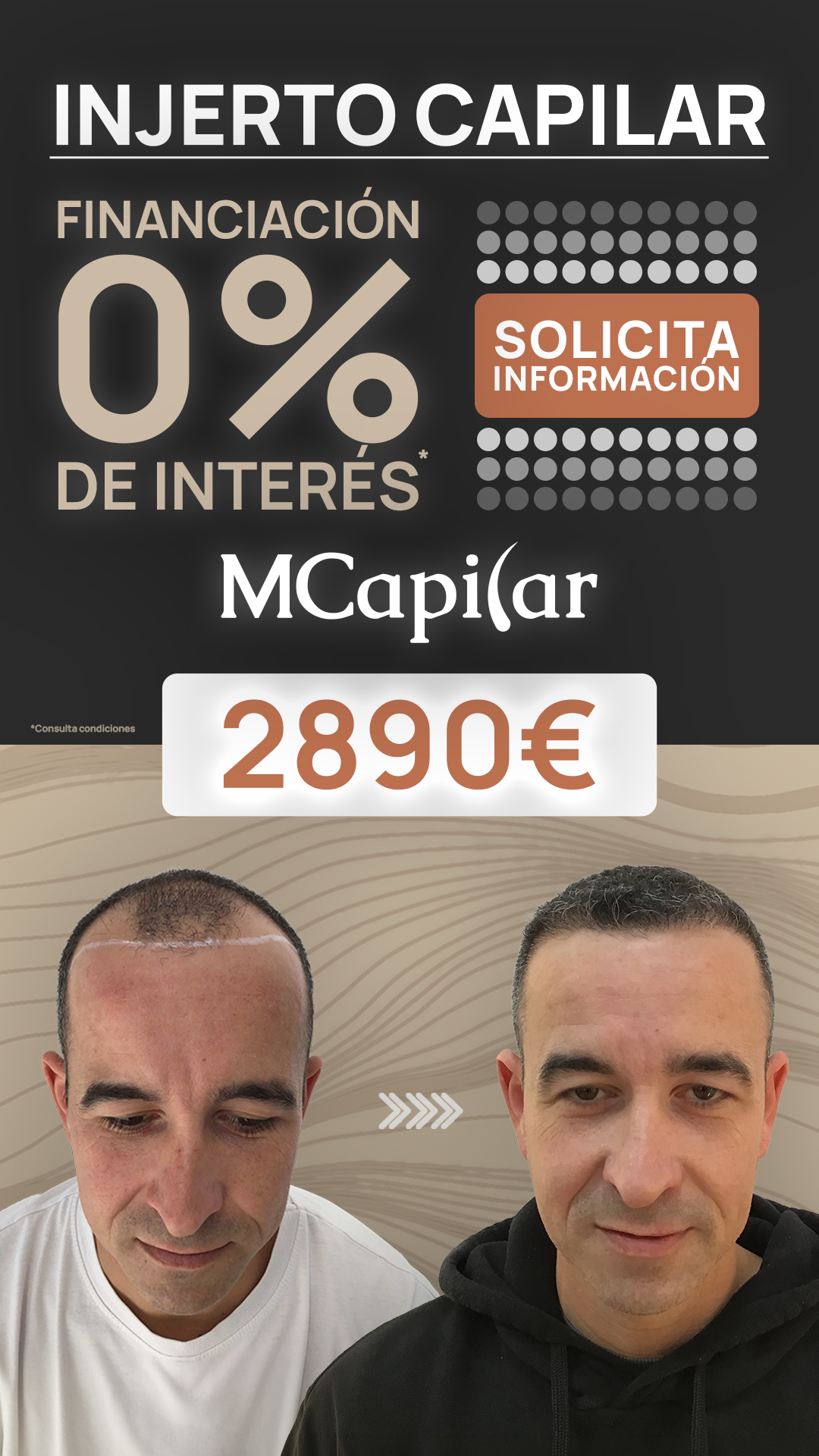 MCapilar Facebook ad