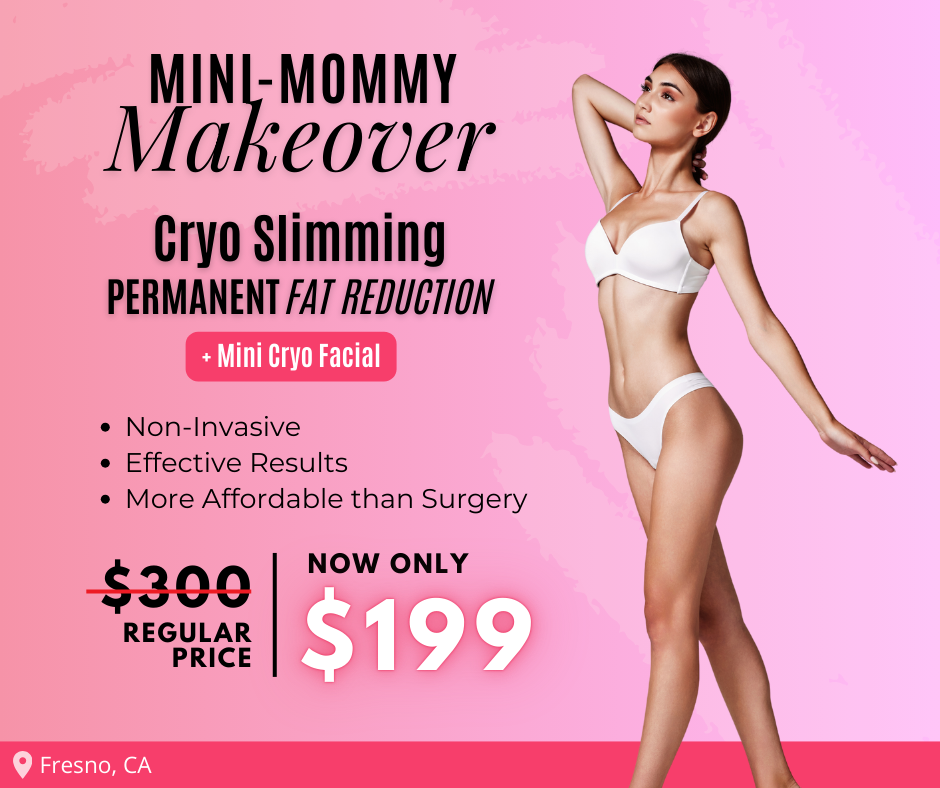 Fresno Beauty Bar Facebook ad: Cryo Slimming + Mini Cryo Facial - Just $199