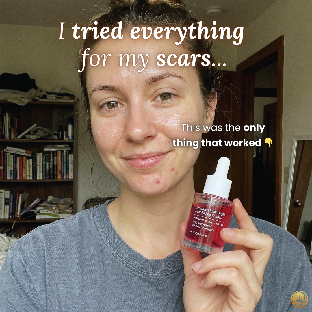Terraura Facebook ad: Why Your Scar Treatments Keep Failing