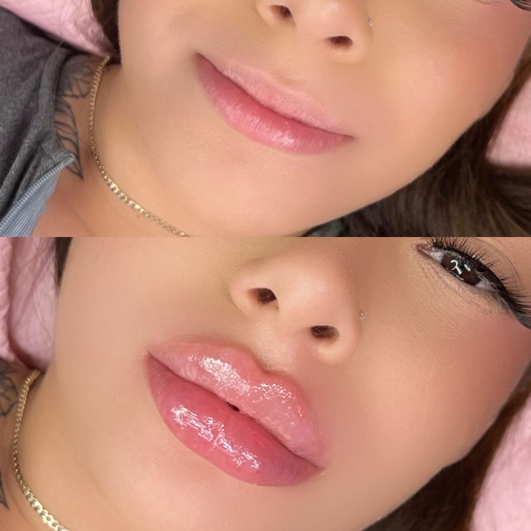 Devonna Mendez Facebook ad: Do you want your dream lips?