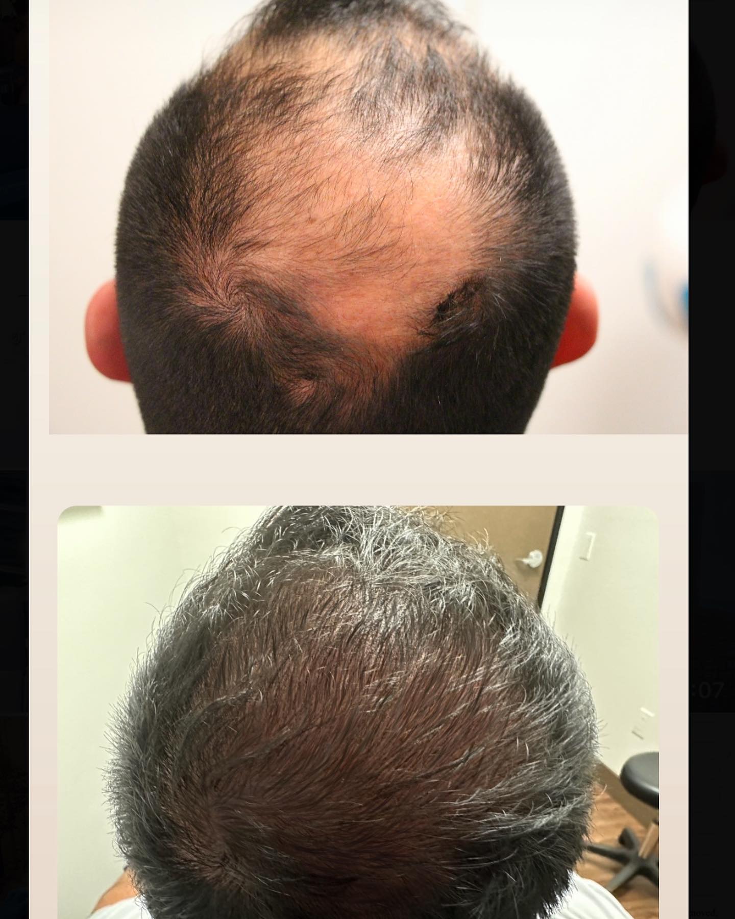 Modena Hair Institute Facebook ad