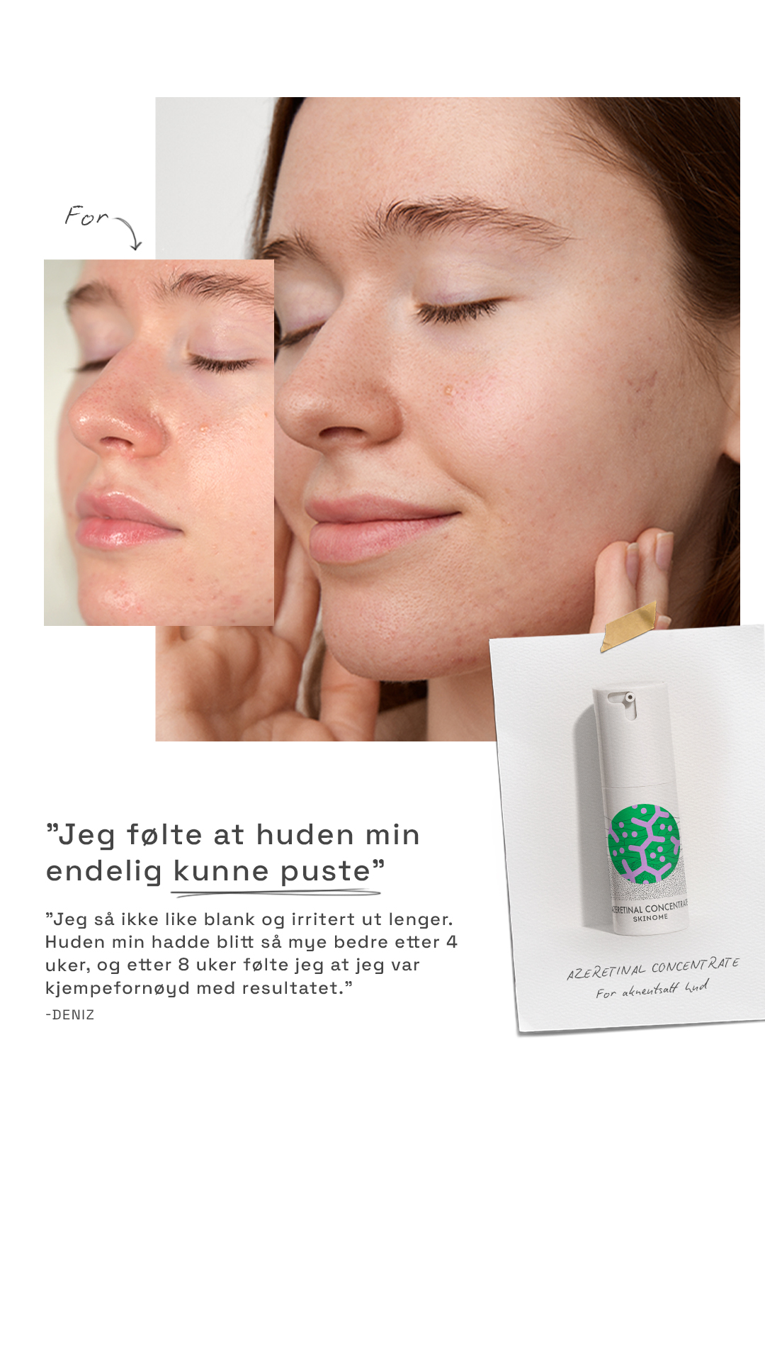 Skinome Facebook ad