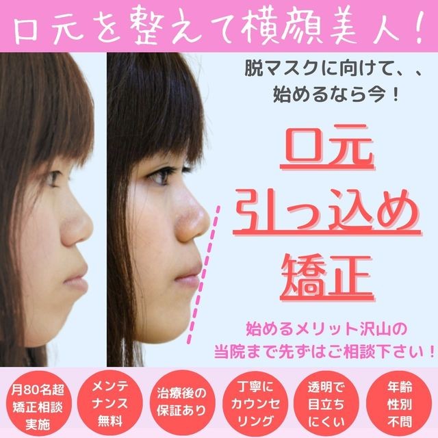 金澤むさし総合歯科・矯正歯科クリニック Facebook ad: 口元の印象を変えて人生を変える!口元引っ込め矯正☆