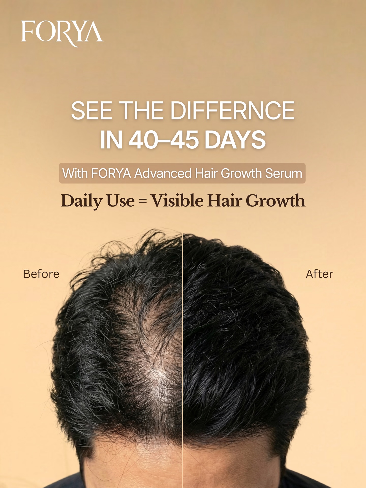 Forya Facebook ad