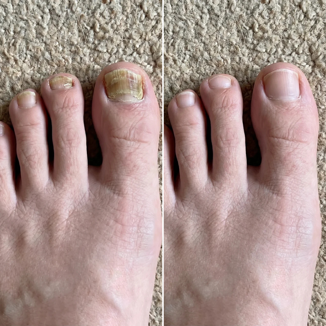 Dr. Jenna Blake, Podiatrist Facebook ad