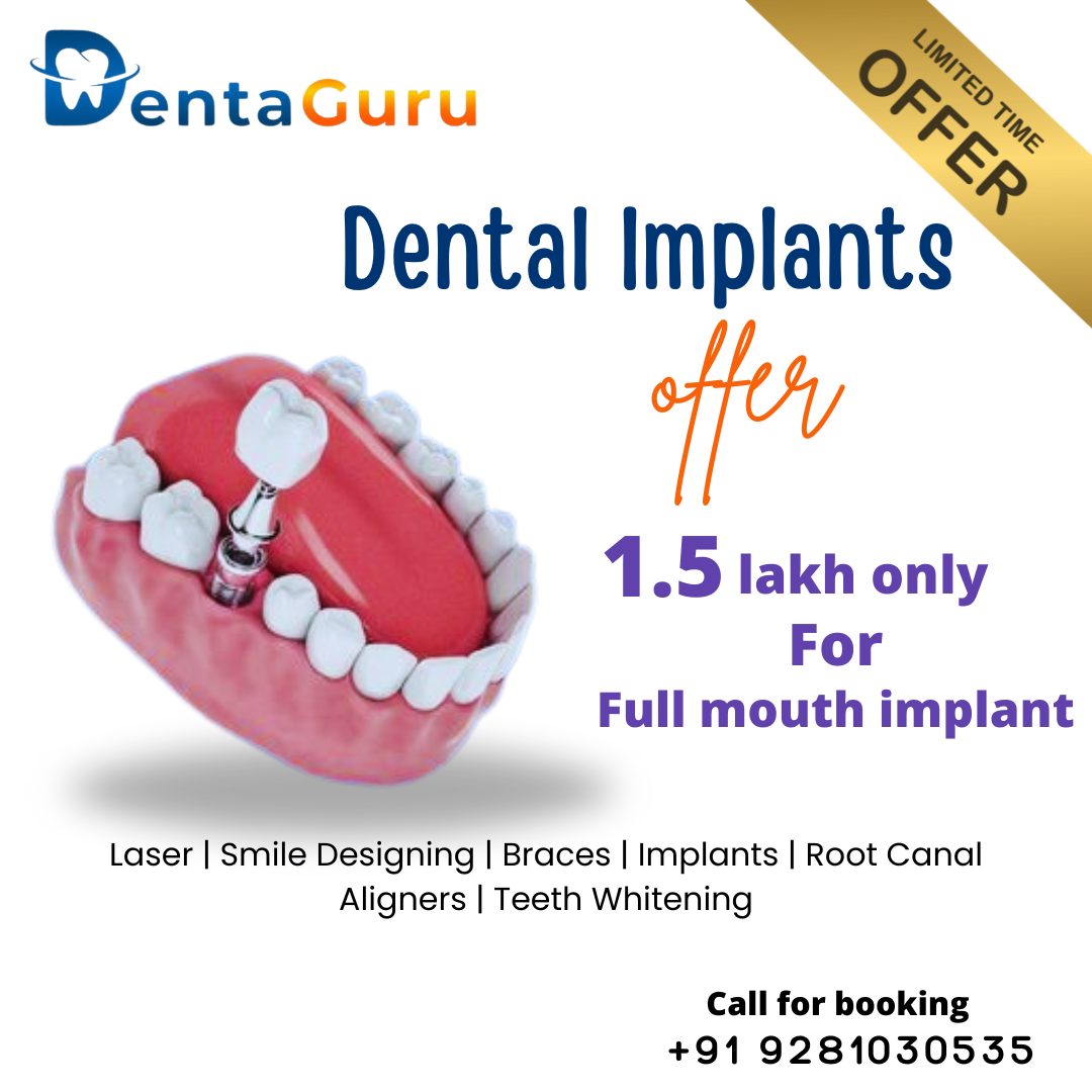 Denta Guru Facebook ad: Chat with us
