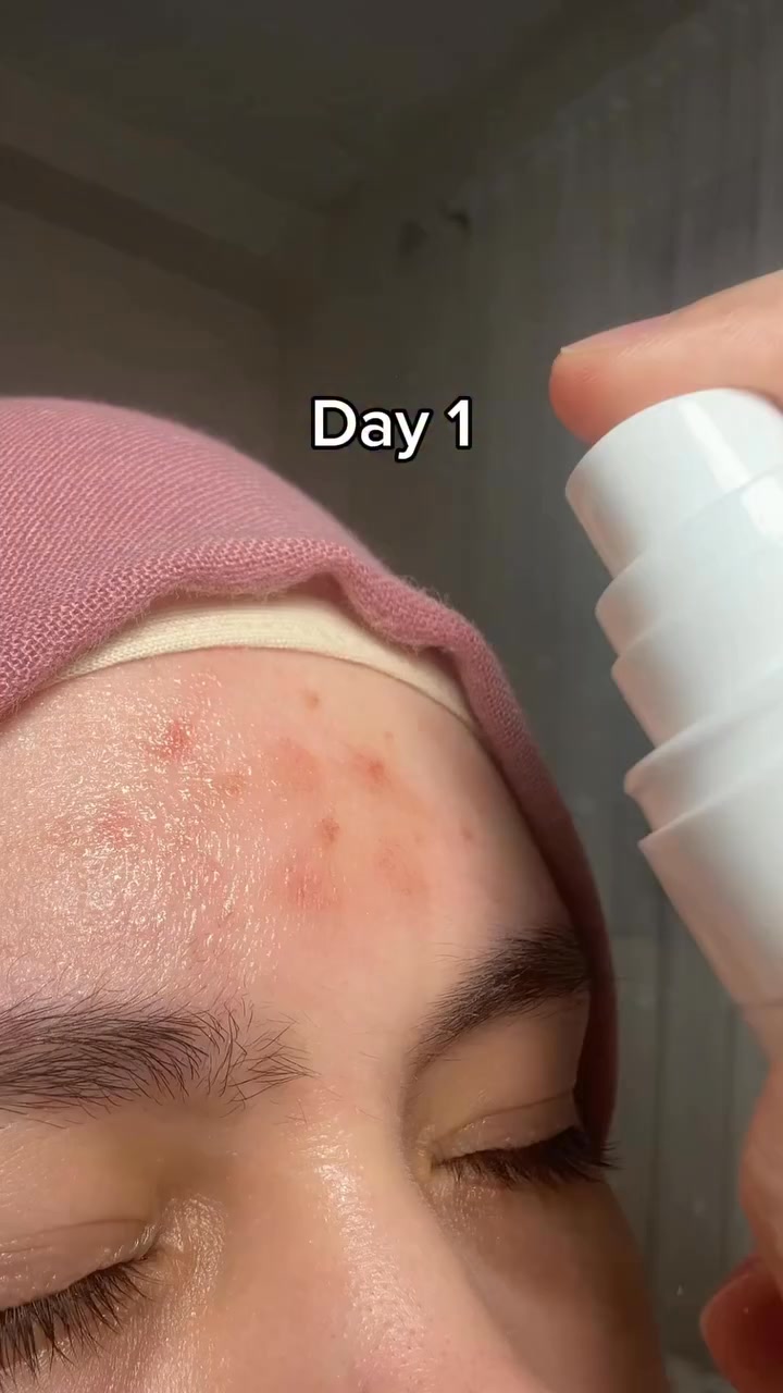 Korean Beautycon - Bangladesh Facebook ad: Dr.Althea 345 Relief Cream Mist 100ml/60ml.