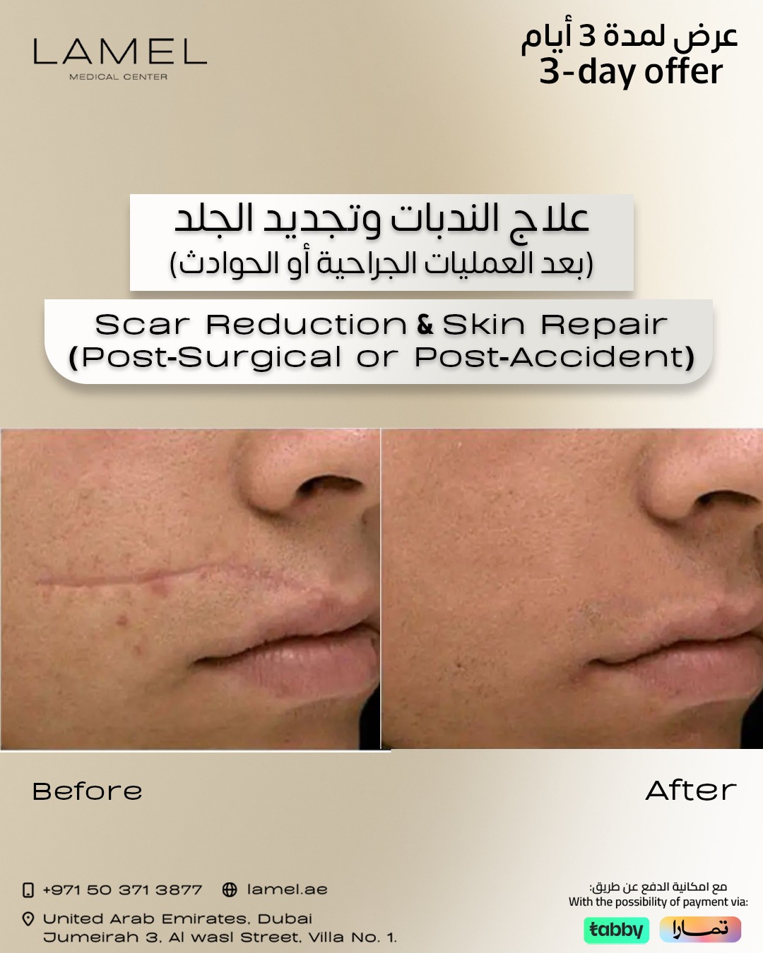 Lamel Medical Center Facebook ad: علاج الندبات وتجديد الجلد ابتداء من 400 درهم احجز/ ي موعدك…