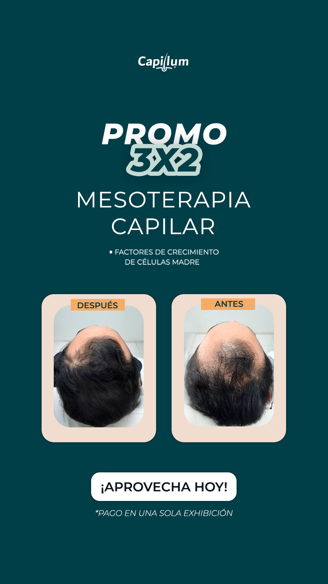 Capillum Facebook ad