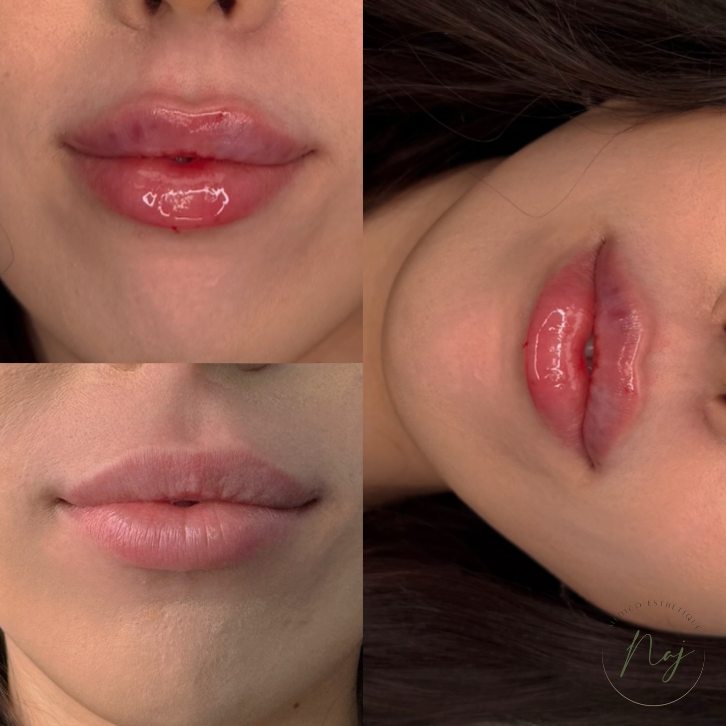 Naj Aesthetics Facebook ad: Prendre un rendez-vous chez Naj Aesthetics Montreal - 4150…