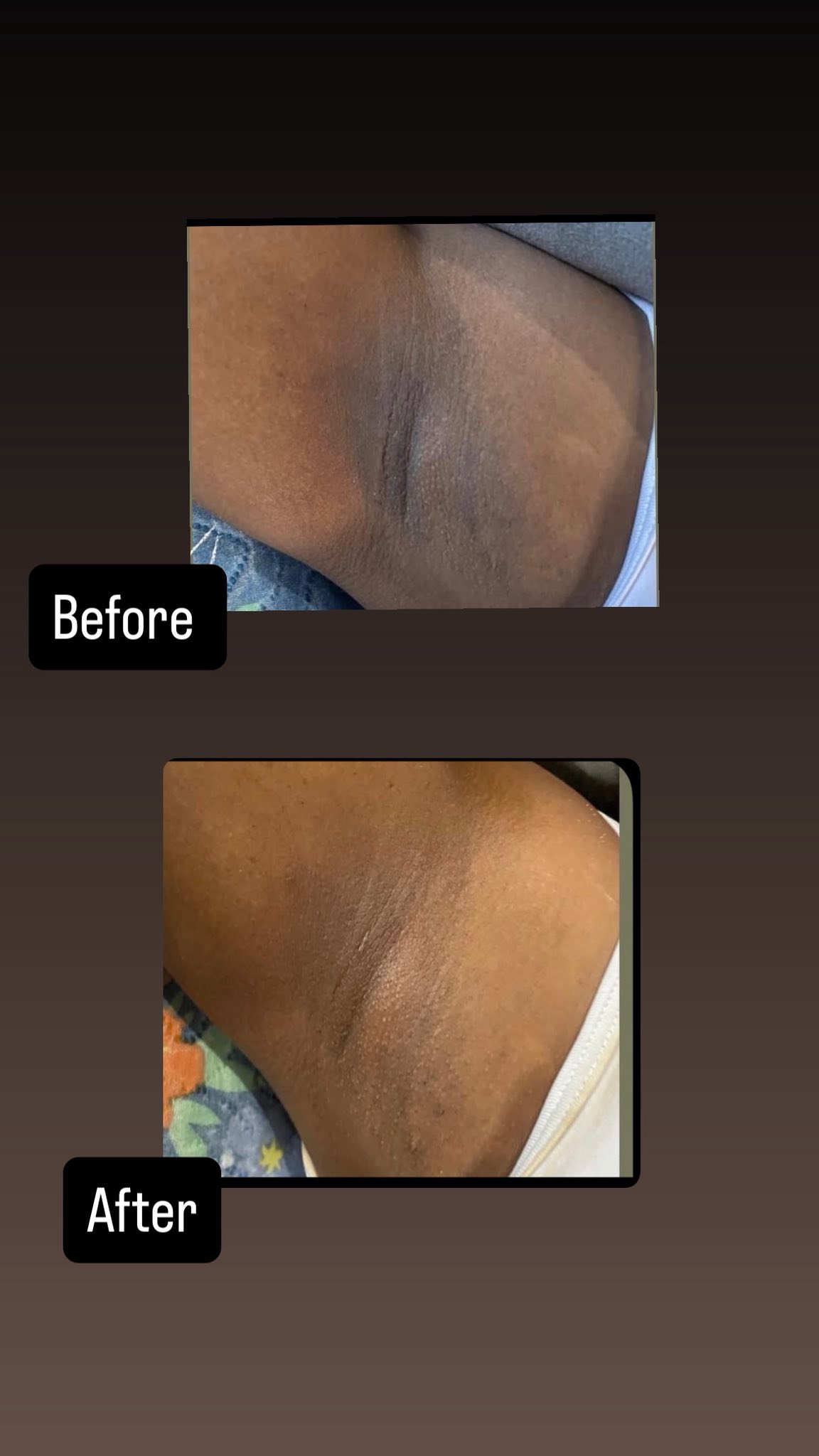 Eco-Luxe Facebook ad: Dark spots? Uneven skin?