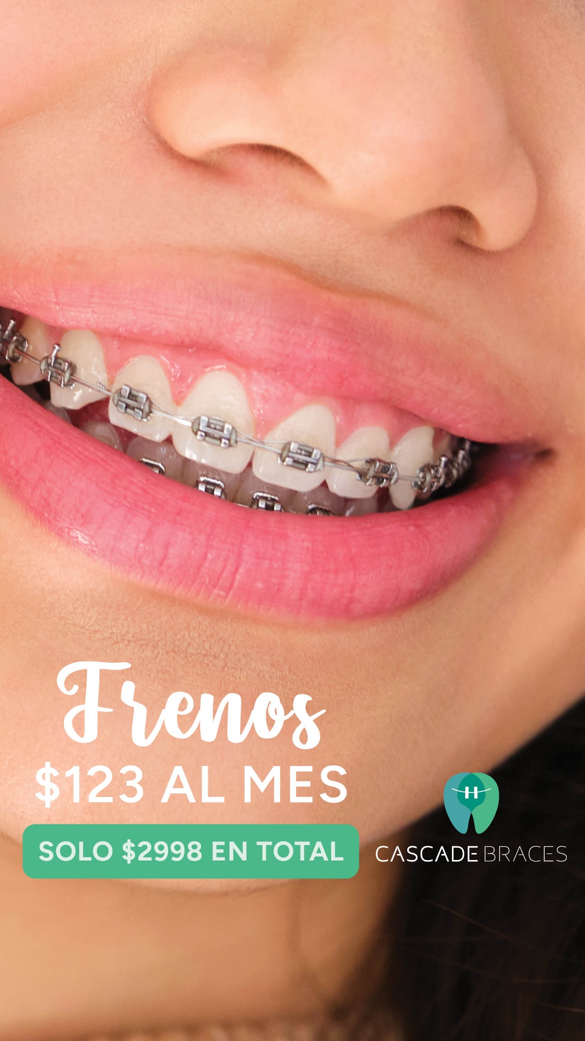 Cascade Braces Facebook ad