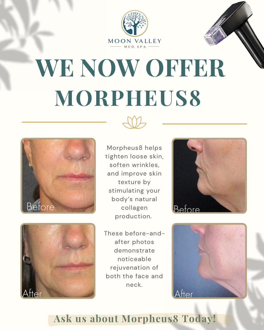 Moon Valley Med Spa Facebook ad