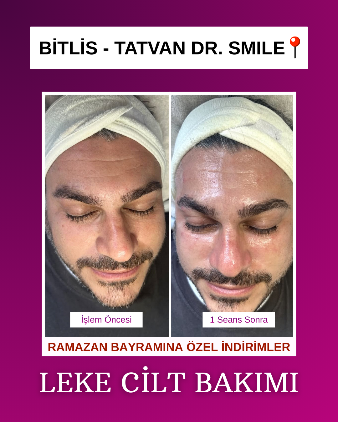 Drsmile.tatvan Facebook ad: 15-25 Temmuz'a özel fırsatları kaçırmayın.