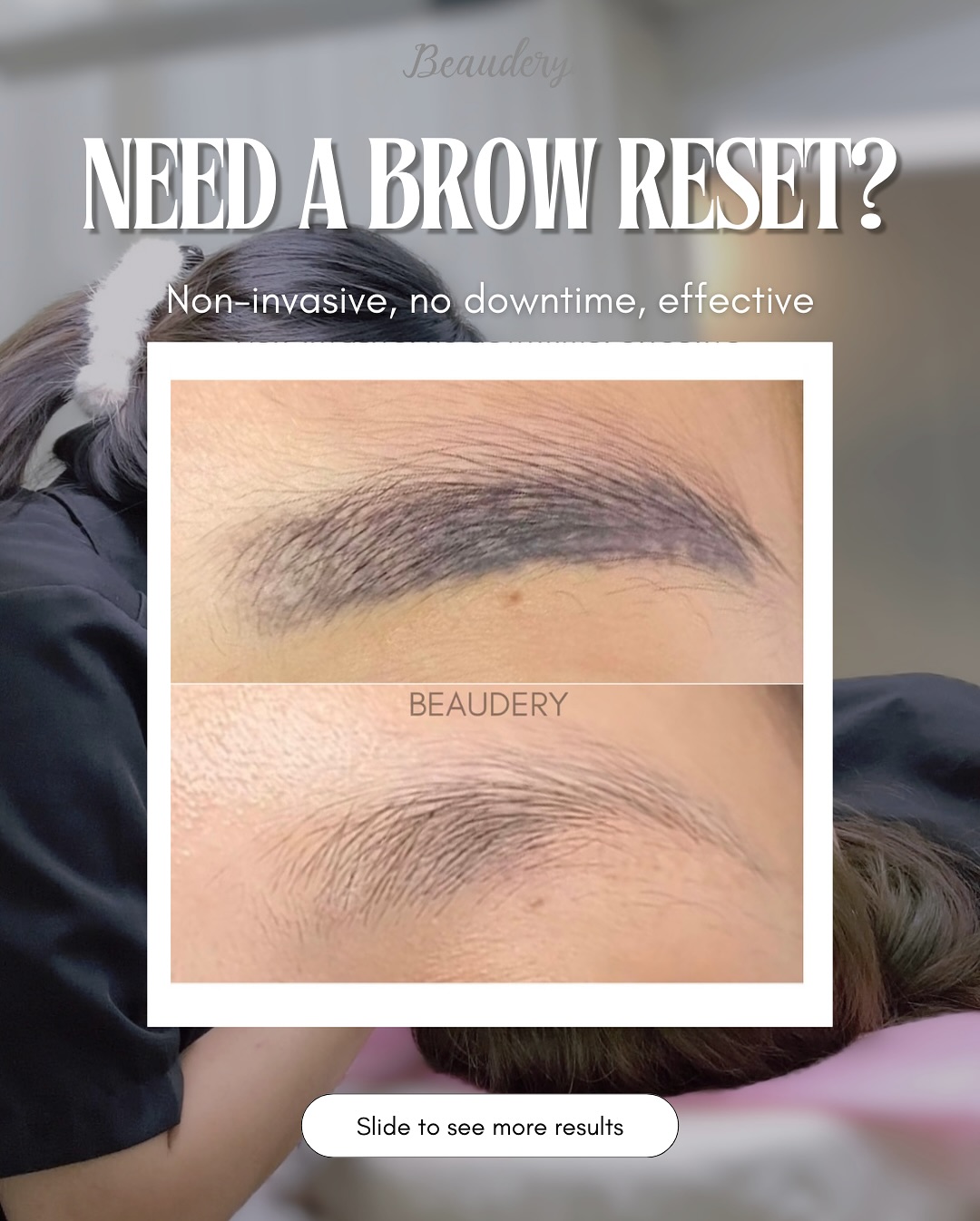 beaudery.sg Facebook ad: Unhappy with your old brow tattoo?
