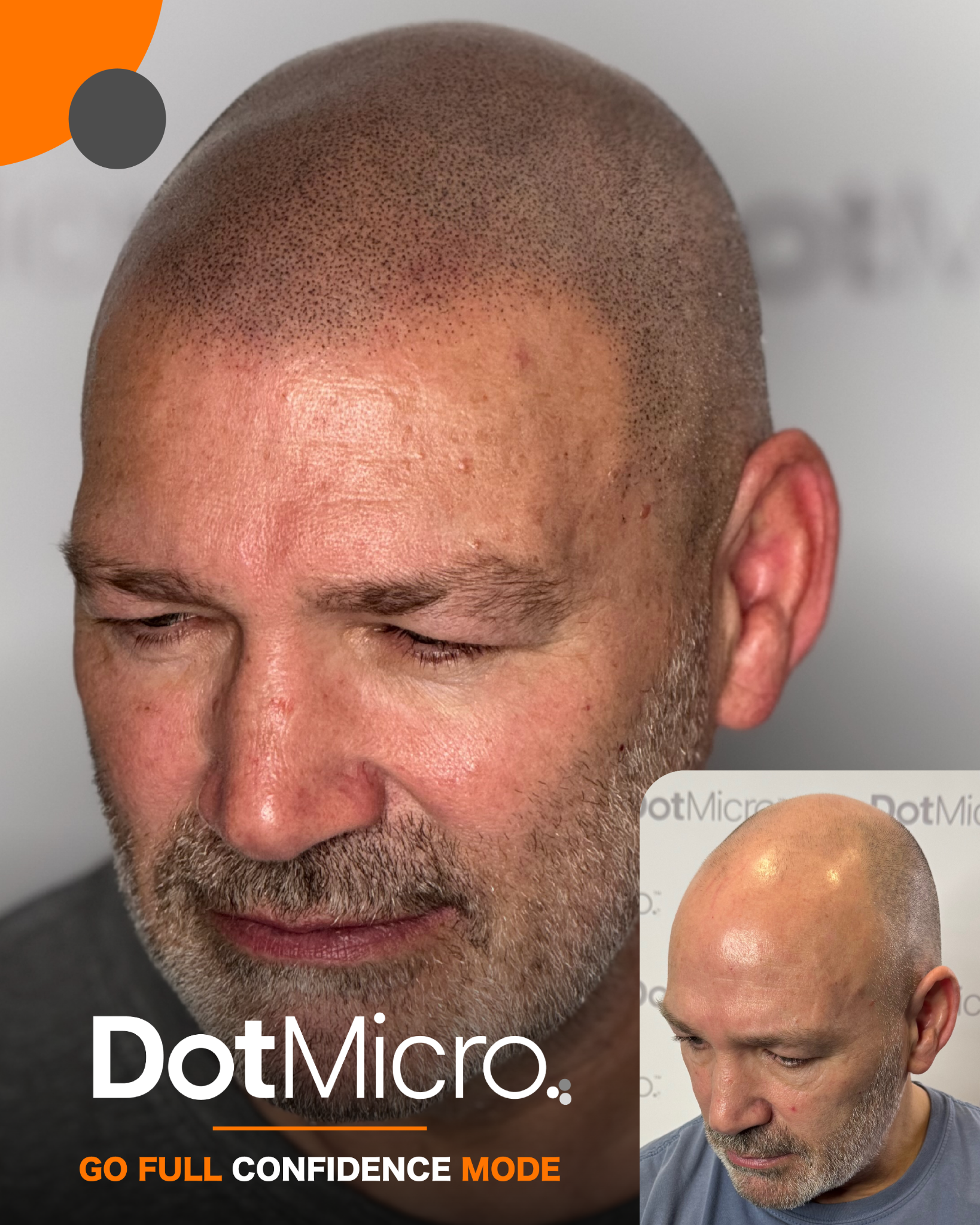 Dot Micro Facebook ad