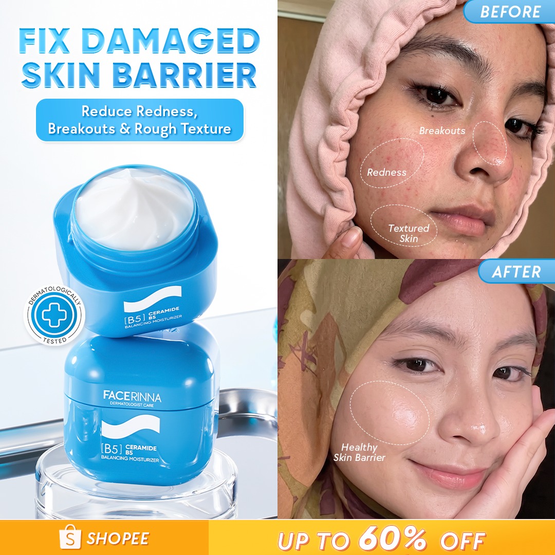 Facerinna Malaysia Facebook ad