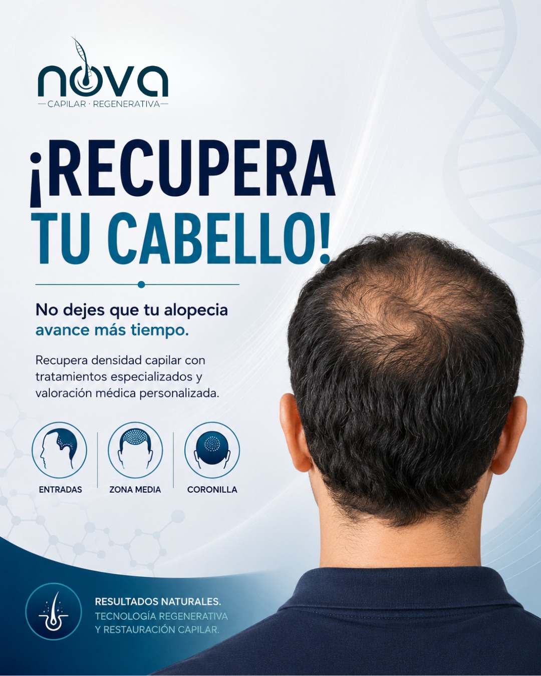 NOVA Capilar Regenerativa Facebook ad: ¿Notas signos de alopecia o menos densidad capilar?