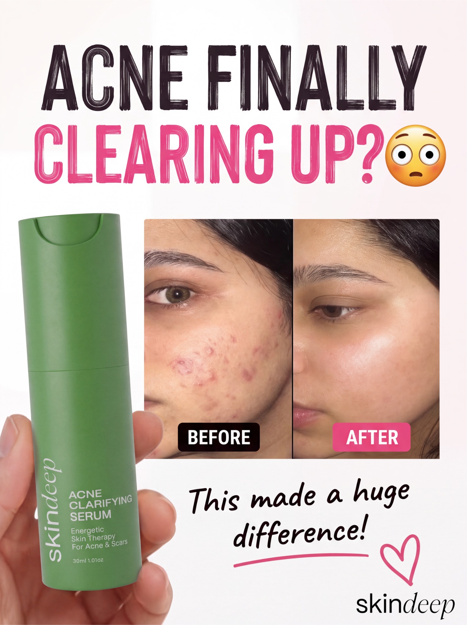 Skin Deep Facebook ad