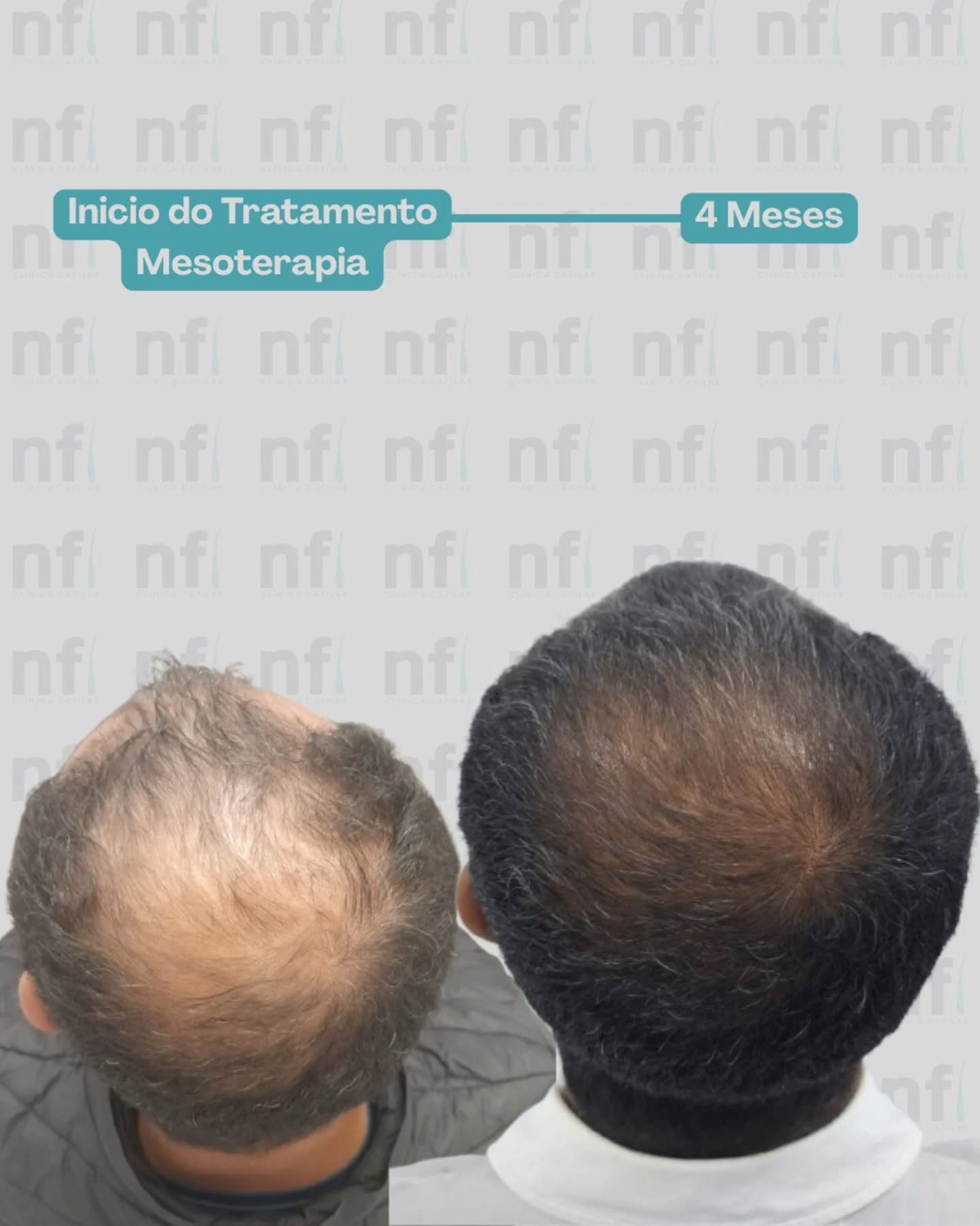 Novofio Jundiaí  Facebook ad