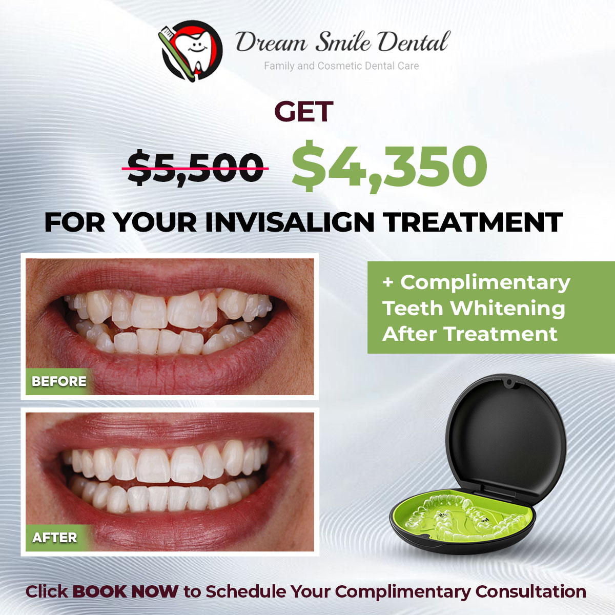 Dream Smile Dental Facebook ad: Invisalign Special in Union City!