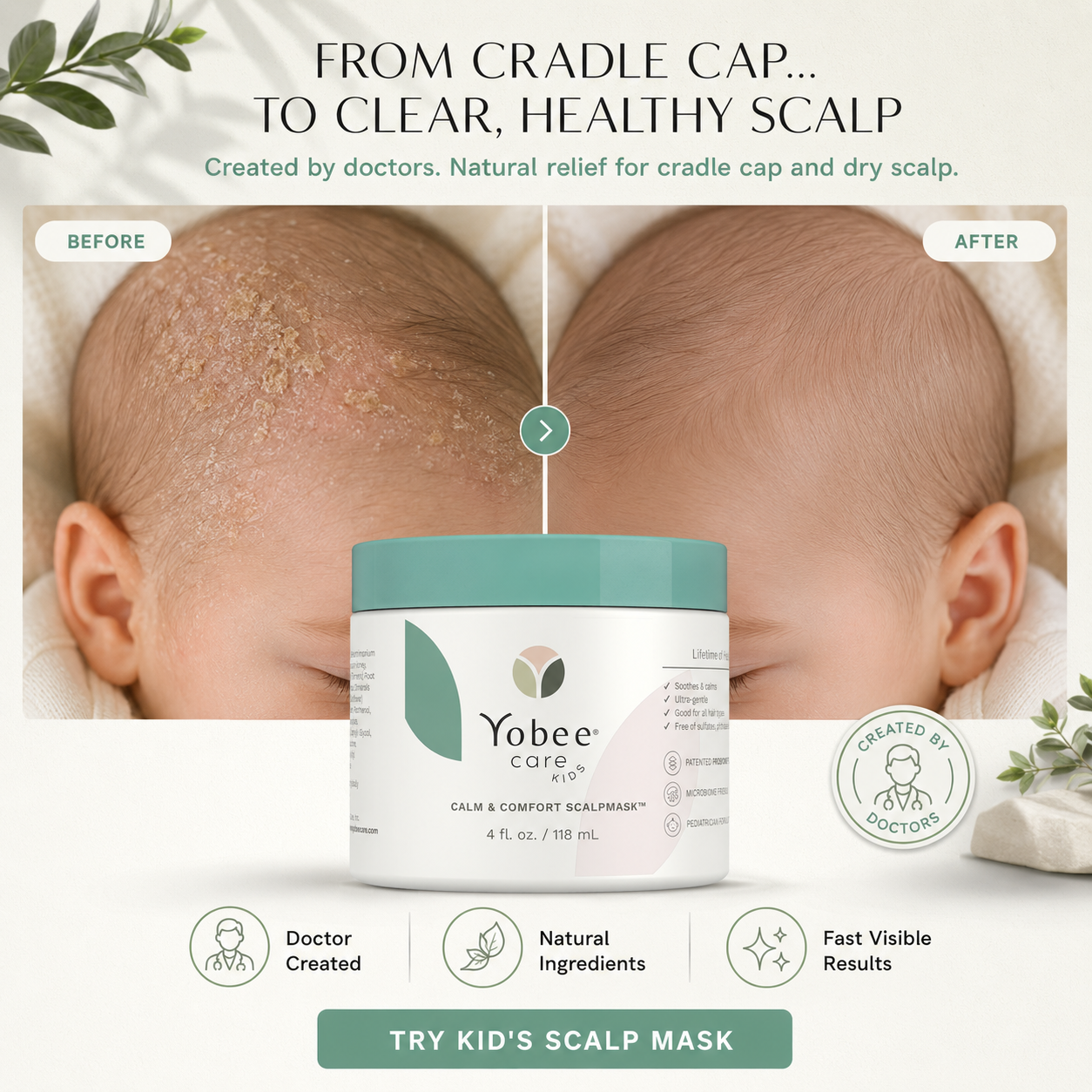 YobeeCare Facebook ad: Still using harsh dandruff shampoos on your child’s…