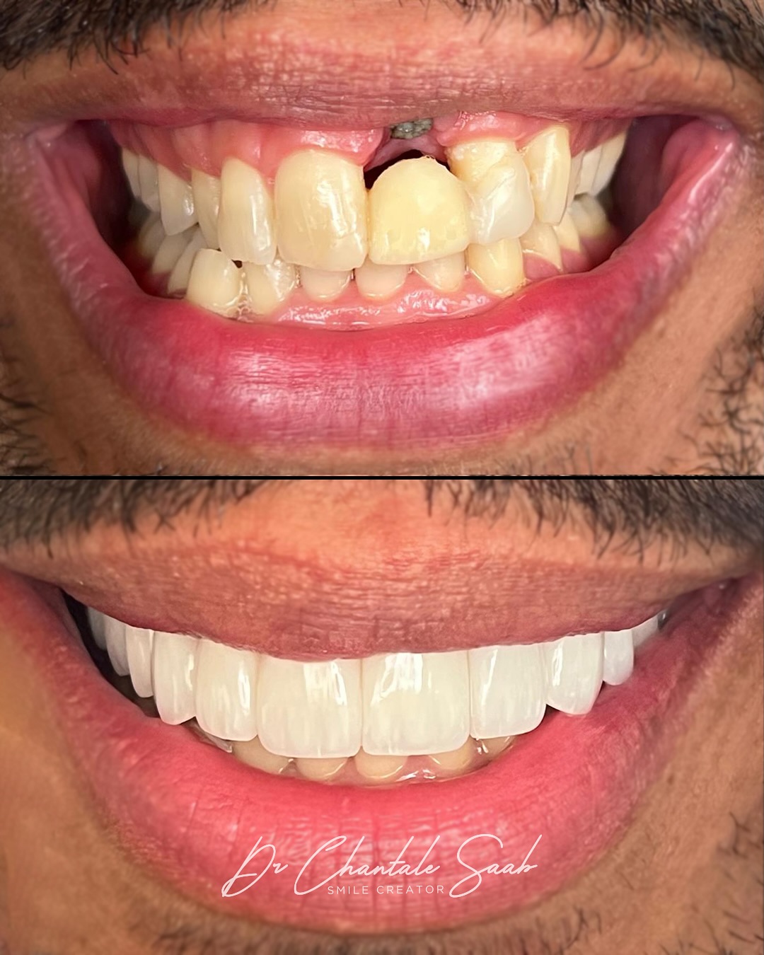 Dr. Chantalesaab Facebook ad: From now to your perfect smile