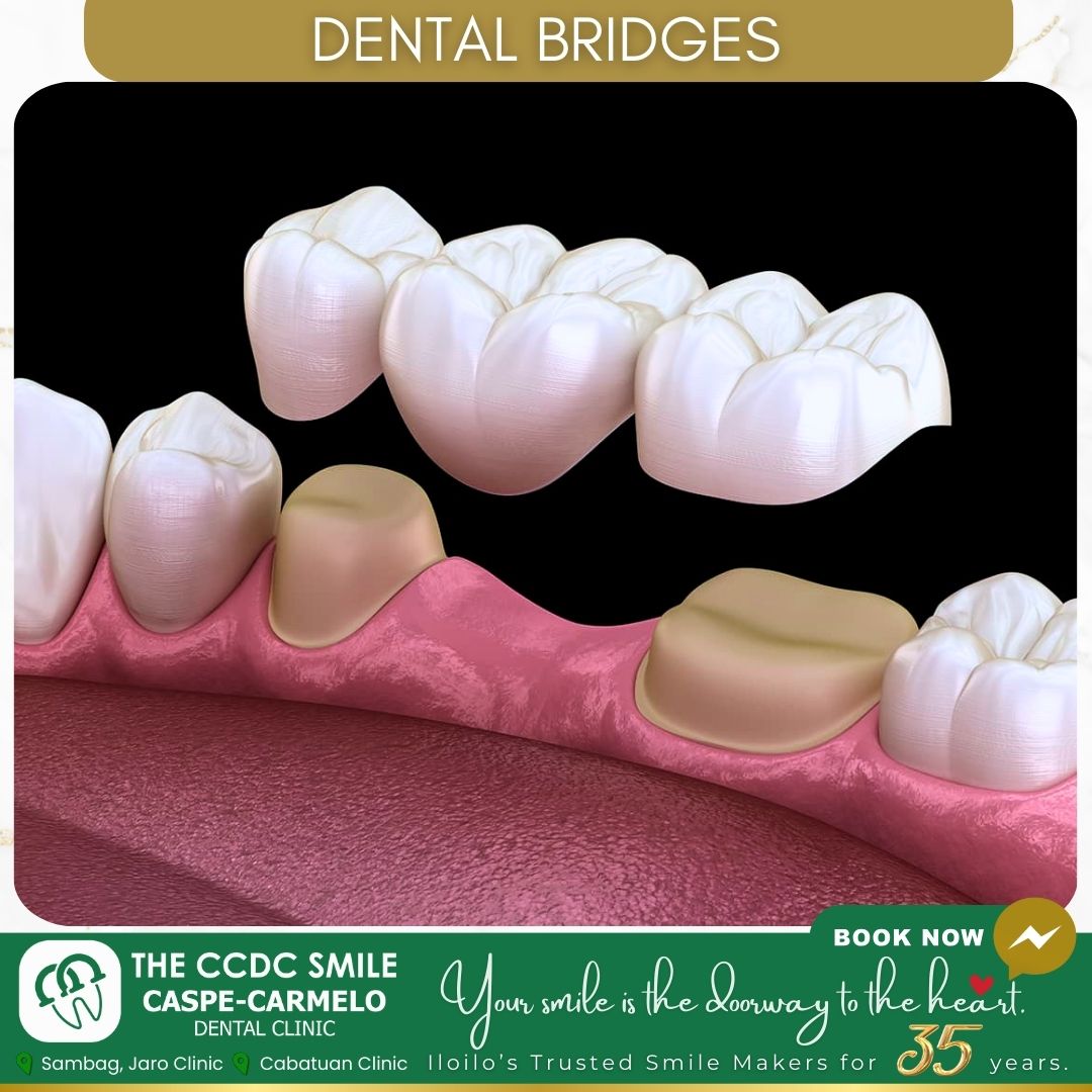 Caspe-Carmelo Dental Clinic / The CCDC Smile Facebook ad: Get 20% Off When you book this month!