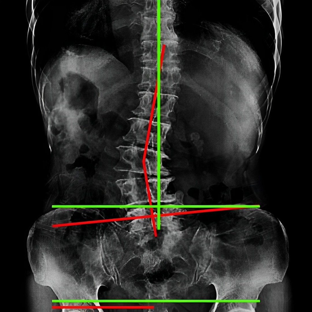 Florida Neuro Pain and Spine Center Facebook ad: Now Accepting New Patients in Panama City, FL!