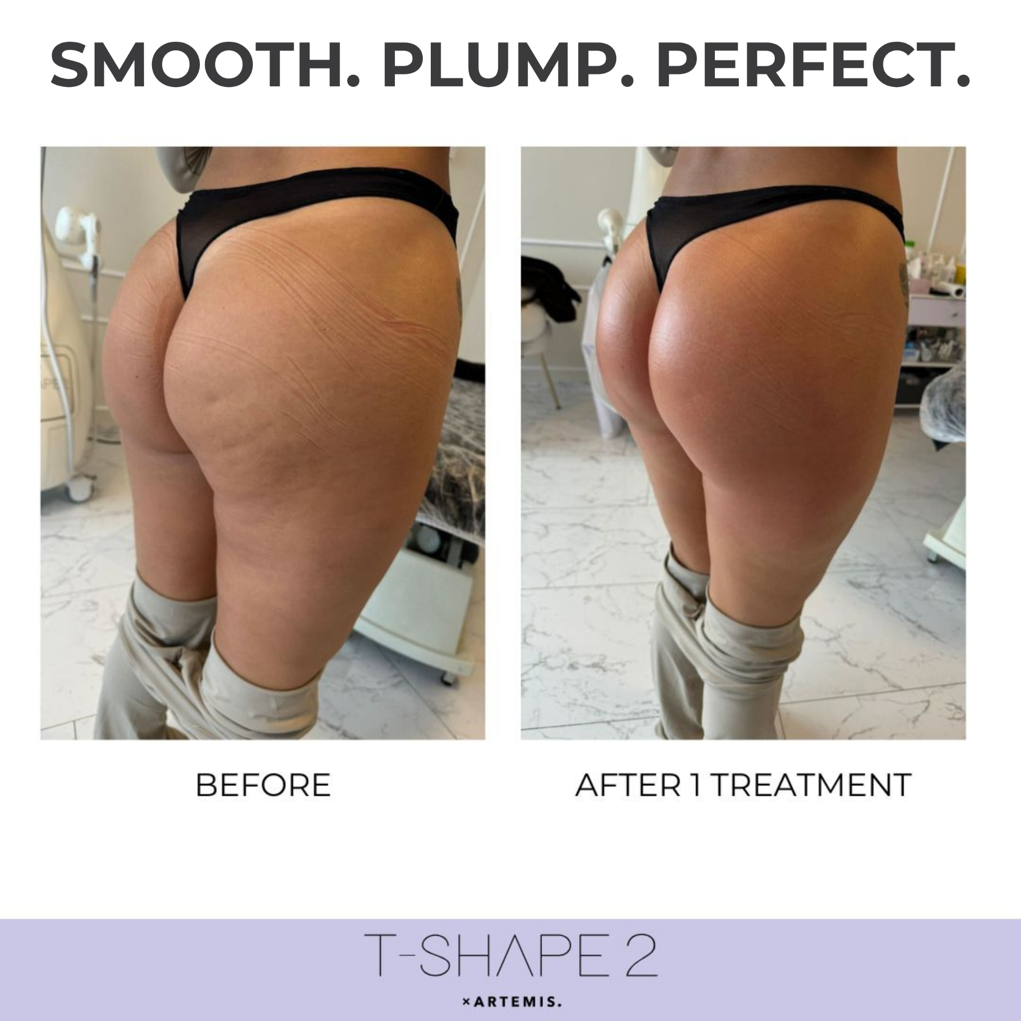 The Covery Wellness - Fruitville Facebook ad: T-Shape Skin Tightening - $149 ONLY