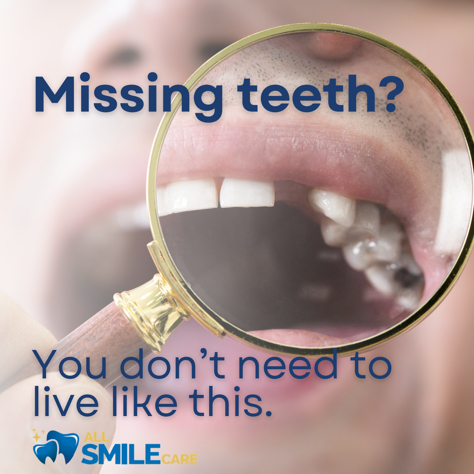 All Smile Care Facebook ad