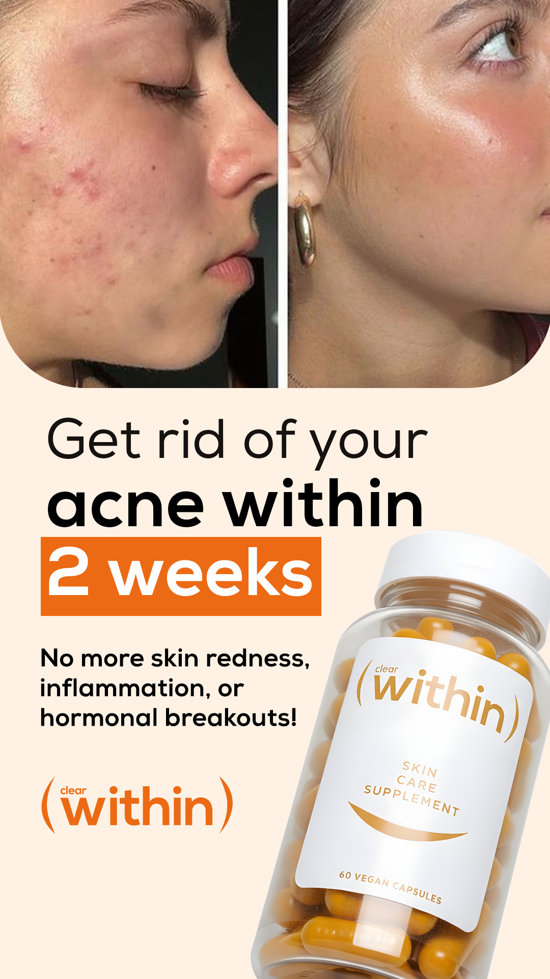 Within Skin Facebook ad