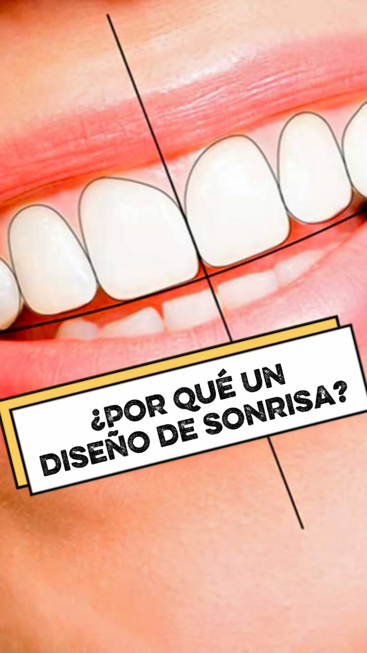 SMILE INC Odontología Especializada Facebook ad: ¿Los diseños de sonrisa se hacen por vanidad?