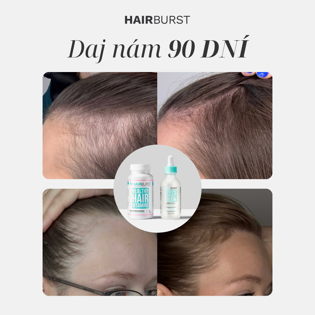 Hairburst SK.CZ Facebook ad