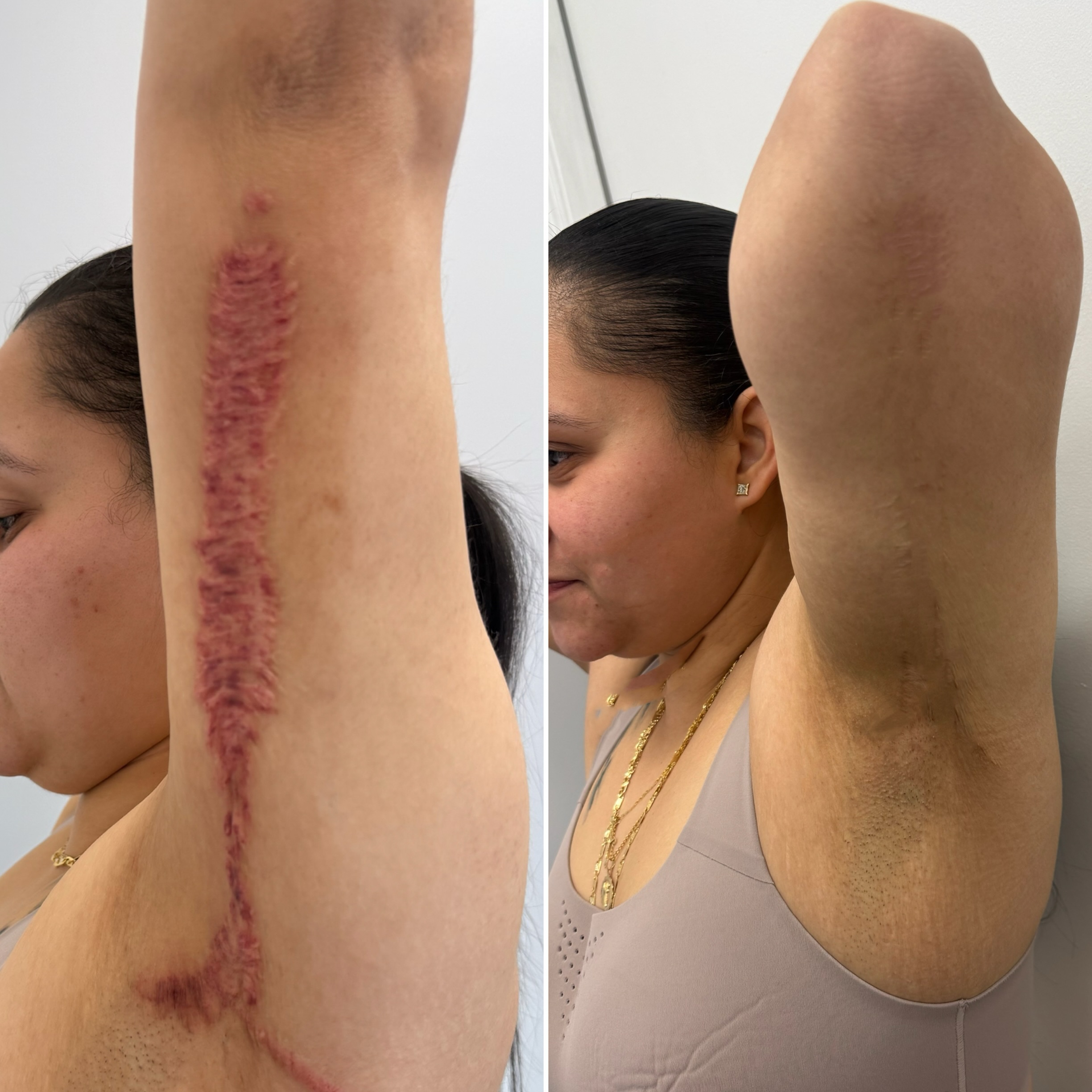 Arch Angels NYC & NJ Permanent Makeup Studio Facebook ad: Life changes, your confidence can evolve with it.
