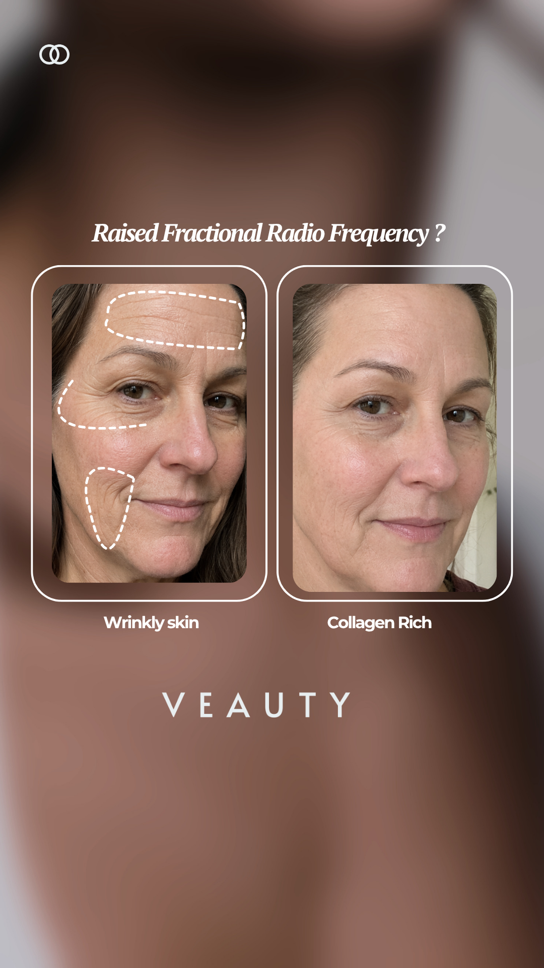 Veauty Facebook ad