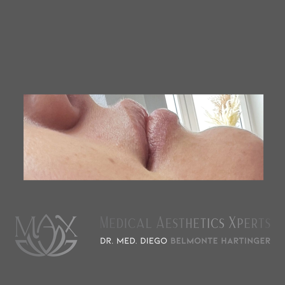 Medical Aesthetics Xperts - MAX Facebook ad