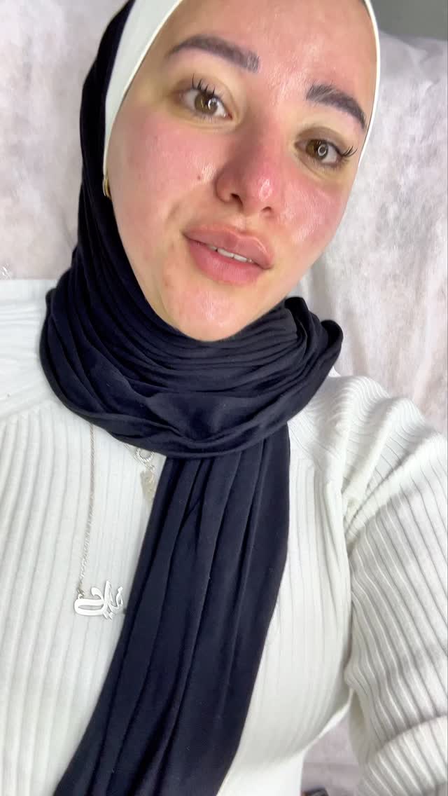 الترا ليزر كلينك Ultra Laser & Skin Care clinic Facebook ad: بعد جلسة الهايدرافيشال… النعومة تحكي عن نفسها