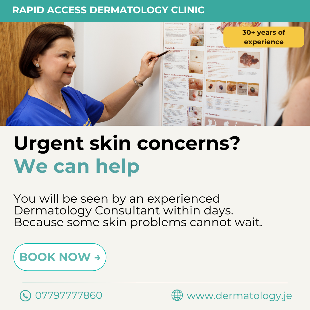 Advanced Dermatology Clinic Jersey Facebook ad